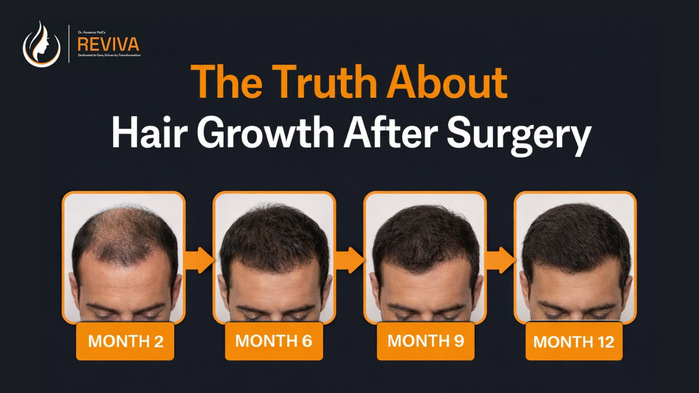 Hair Transplant Results: